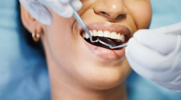 Best Emergency Dental Care for Abscessed Tooth in Preston, TX