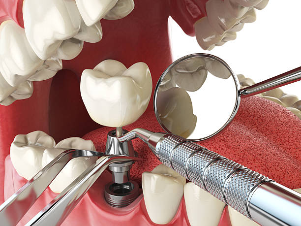 Best Urgent Dental Care for Toothache in Preston, TX